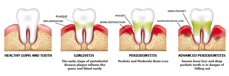 Dental Patient