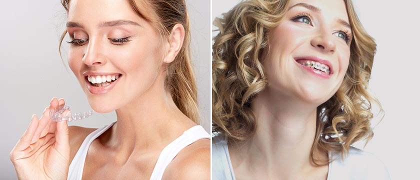InvisalignⓇ vs Braces—Which One Is Right for You?