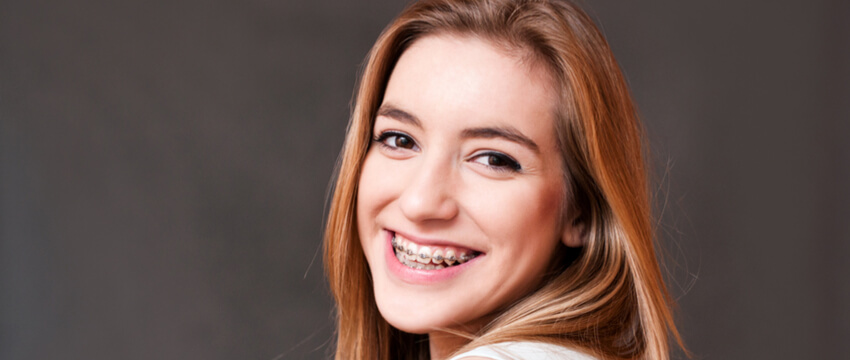 Cost Of Braces – Find The One That Suits You